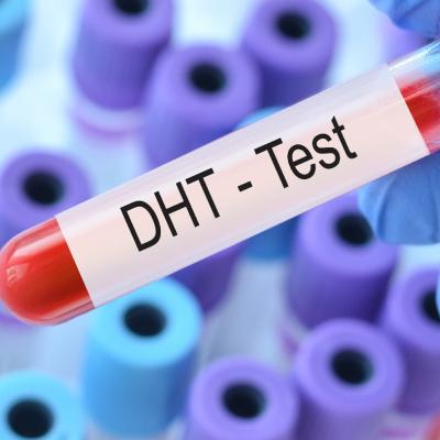 درباره هورمون DHT چه می‌دانید؟