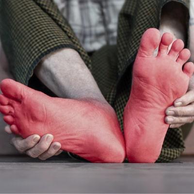 آشنایی با 7 علت داغ شدن کف پا و سوزن‌سوزن شدن