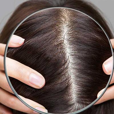 اسکالپ سر: چگونه از سلامت پوست سر و موی خود مراقبت کنیم؟