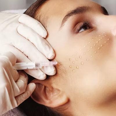 مزوتراپی صورت: راز جوانی پوست بدون جراحی