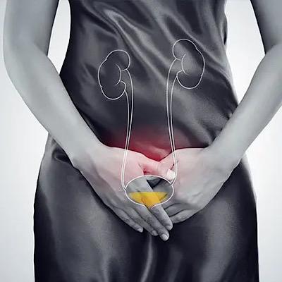 سریع‌ترین درمان خانگی سوزش ادرار با 12 روش ساده