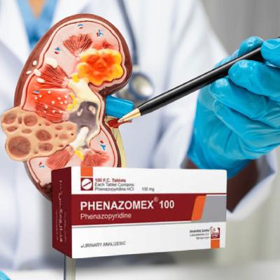 قرص فنازومکس؛ تسکین فوری درد و سوزش ادرار